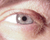 eye